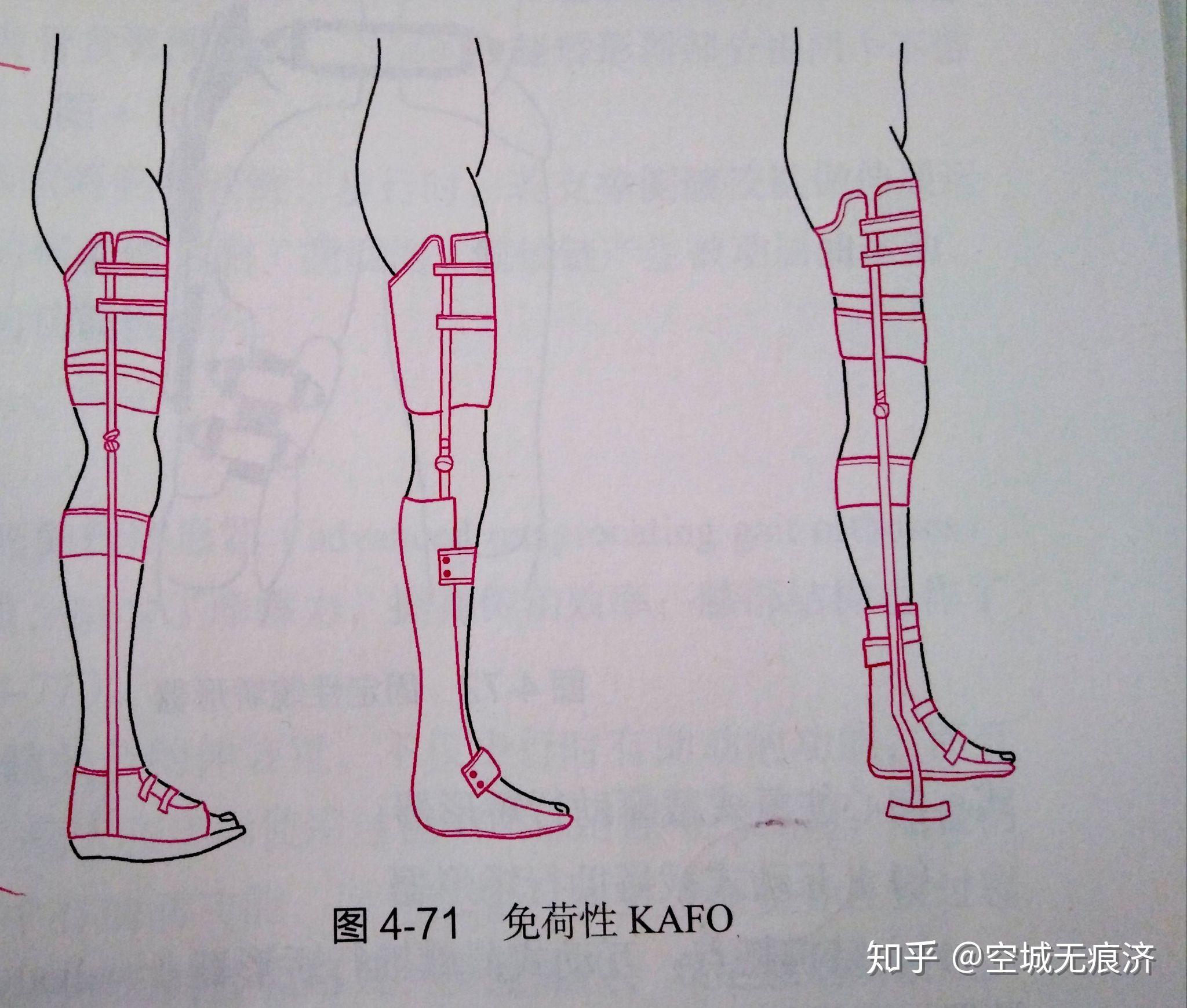 臨床康復(fù)工程學(xué) 假肢與矯形器的功能、設(shè)計(jì)與發(fā)展